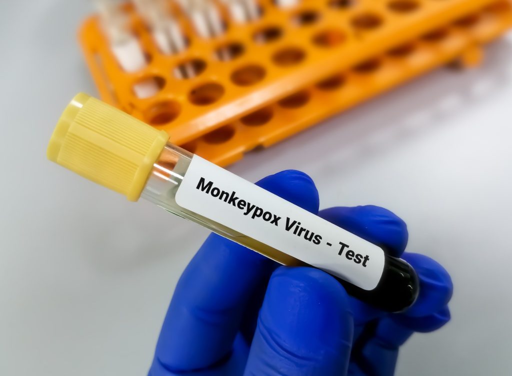 Health care worker wearing blue surgical glove holding a test tube labeled Mokeypox Virus Test.